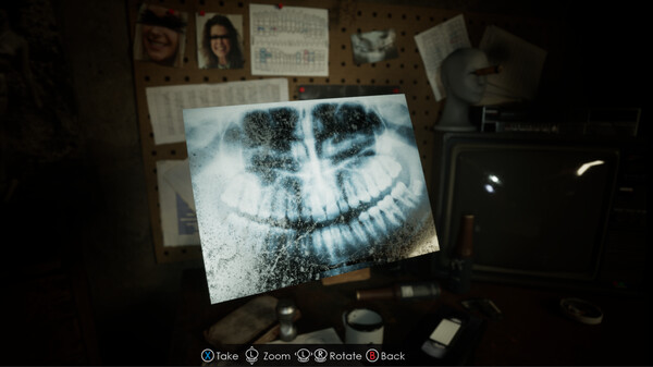 《下颌松弛》游戏截图