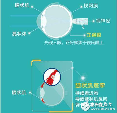 VR技术将如何改变近视患者的治疗方式