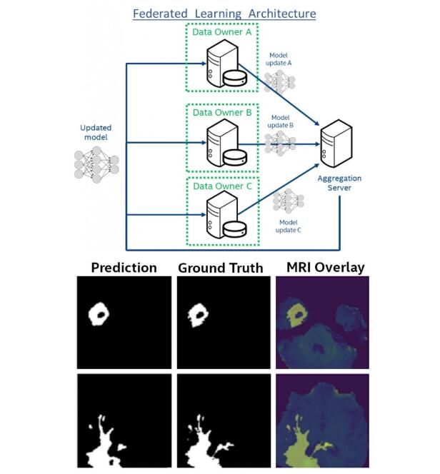 医学院正在研究一个人工智能,可以帮助识别脑瘤