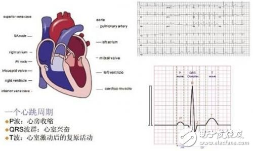 利用ECG AFE简化病人监护仪设计