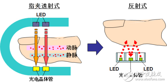 擦亮眼睛!看清穿戴医疗终极目标