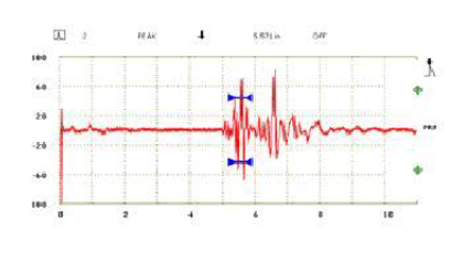 前置放大器工作原理