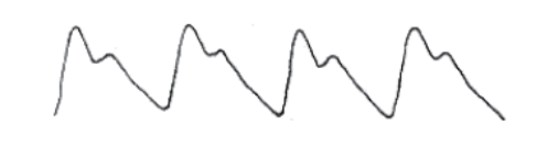 可穿戴设备工作原理总结