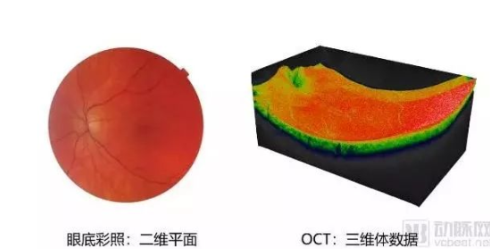 20万次每秒扫频激光OCT发布，国产设备将在眼科领域后来居上