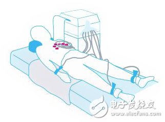 高可靠性心脏监护仪设计详解