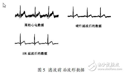 DIY自己的家庭电子医疗箱 软硬件设计方案 （二）前置放大和抗干扰