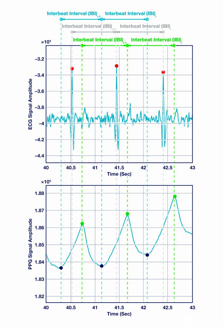 poYBAGPYeb6AB0yyAAFurO3JEt4339.jpg?h=270&hash=4775B23C9FD23D9608A9F9377CA42C893A083A93&la=en&imgver=4